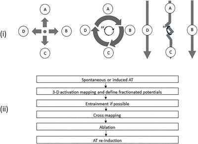 The Roles of Fractionated Potentials in Non-Macroreentrant Atrial Tachycardias Following Atrial Fibrillation Ablation: Recognition Beyond Three-Dimensional Mapping